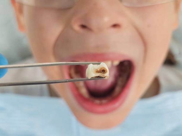Best Emergency Gum Pain Relief  in Cannon Falls, MN